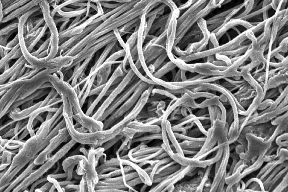 New ultra-fine fibres created by the MIT team are seen in a Scanning Electron Microscope (SEM) image. Courtesy of the researchers